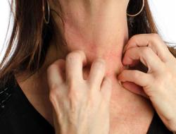Покраснение на шее и зуд — определение причин и варианты лечения