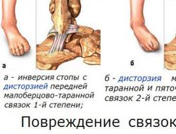 Nyeri tulang dari lutut hingga kaki