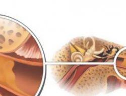 كيفية إزالة سدادات الشمع من الأذنين، هل من الضروري القيام بذلك؟