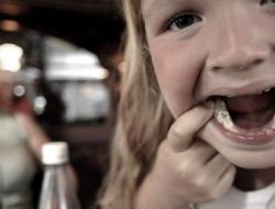 Penyebab karies gigi sulung pada anak kecil dan metode pengobatan dengan foto