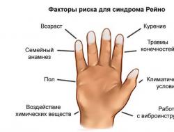 De främsta orsakerna till domningar i långfingret på vänster hand