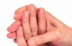 Jeśli palce drętwieją: przyczyny, leczenie i zapobieganie Jaki rodzaj choroby występuje, gdy palce drętwieją